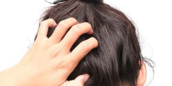 علت خارش سر و ریزش مو در زنان + علت خارش پشت سر در شب